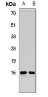 Polyclonal Rabbit anti-Human RMI2 / C16orf75 Antibody (WB)