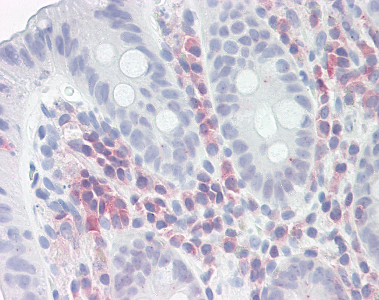 Polyclonal Rabbit anti-Human PSME1 Antibody (aa72-121, IHC, WB)