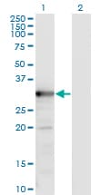 IHC-plus™ TS / Thymidylate Synthase Antibody (clone 2B2)