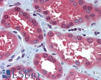 IHC-plus™ Polyclonal Rabbit anti-Human NUDT21 Antibody (IHC)