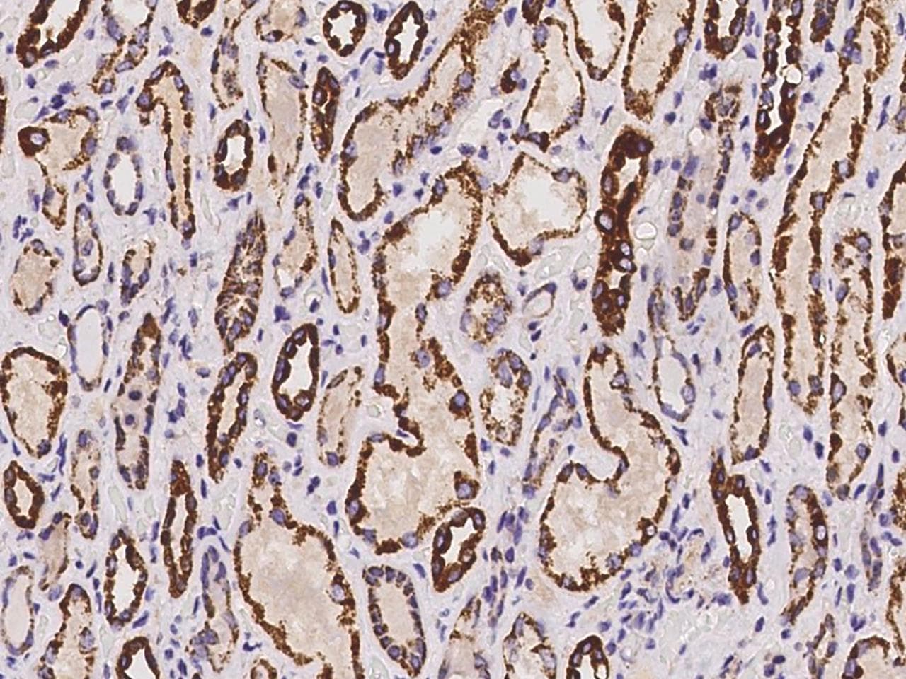 Polyclonal Rabbit anti-Human CLYBL Antibody (IHC)