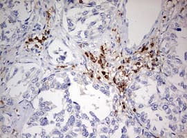 Monoclonal Mouse anti-Human DOCK2 Antibody (clone OTI7G2, aa1544-1830, IHC, WB)