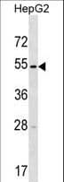 Polyclonal Rabbit anti-Human TMPRSS11E Antibody (aa249-277, WB)