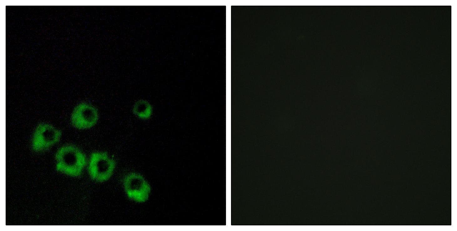 VIPR1 Antibody