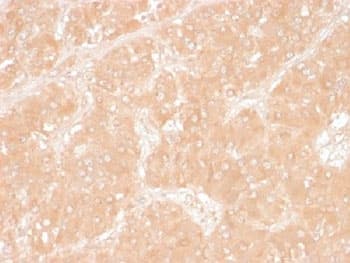 PLIN2 / ADFP / Adipophilin Antibody (clone ADFP/1366)