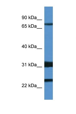 Polyclonal Rabbit anti-Mouse KCND1 / Kv4.1 Antibody (N-Terminus, WB)