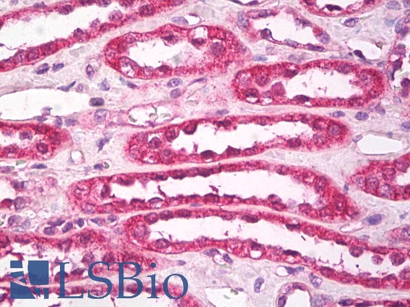 IHC-plus™ AQP1 / Aquaporin 1 Antibody (aa1-10)