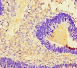 Polyclonal Rabbit anti-Human TMEM207 Antibody
