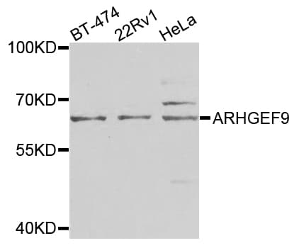 ARHGEF9 / Collybistin Antibody