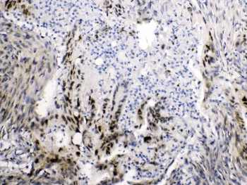 Polyclonal Rabbit anti-Human I-FABP / FABP2 Antibody (IHC, WB)