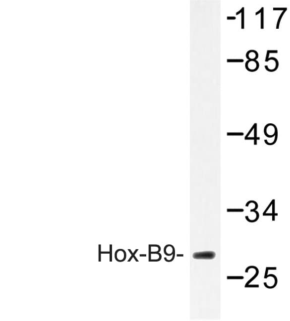 HOXB9 Antibody (Arg237)