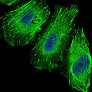 FOXO1 / FKHR Antibody (clone 3B6)