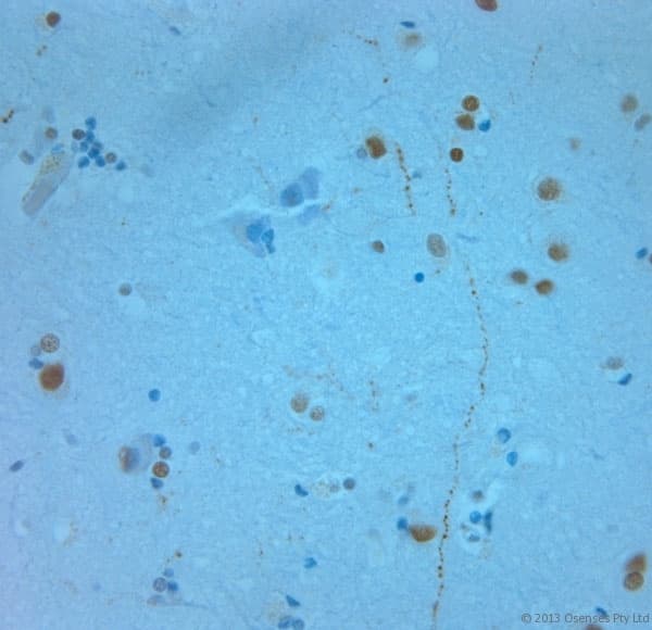REEP6 Antibody (aa2-50)