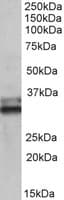 PathPlus™ ETFA Antibody (aa139-152)