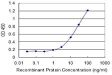 Monoclonal Mouse anti-Human CCDC115 Antibody (clone 4E9, IHC, WB)
