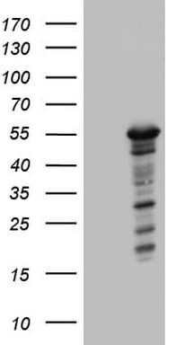 ZNF500 Antibody (aa102-325, clone OTI2C1)