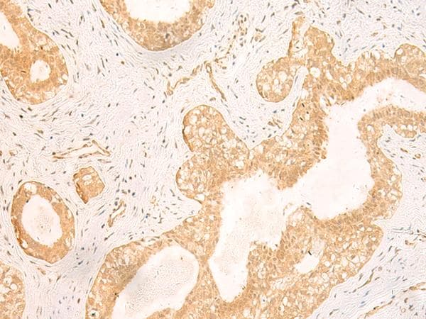 GSG1L Antibody