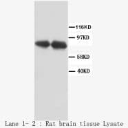 VR1 / TRPV1 Antibody (N-Terminus)