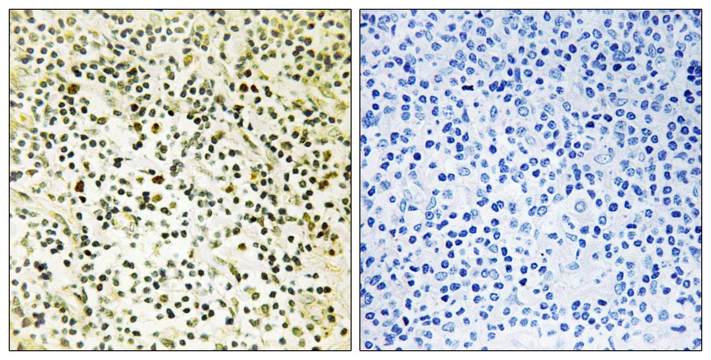 NPM1 / NPM / Nucleophosmin Antibody (p234)