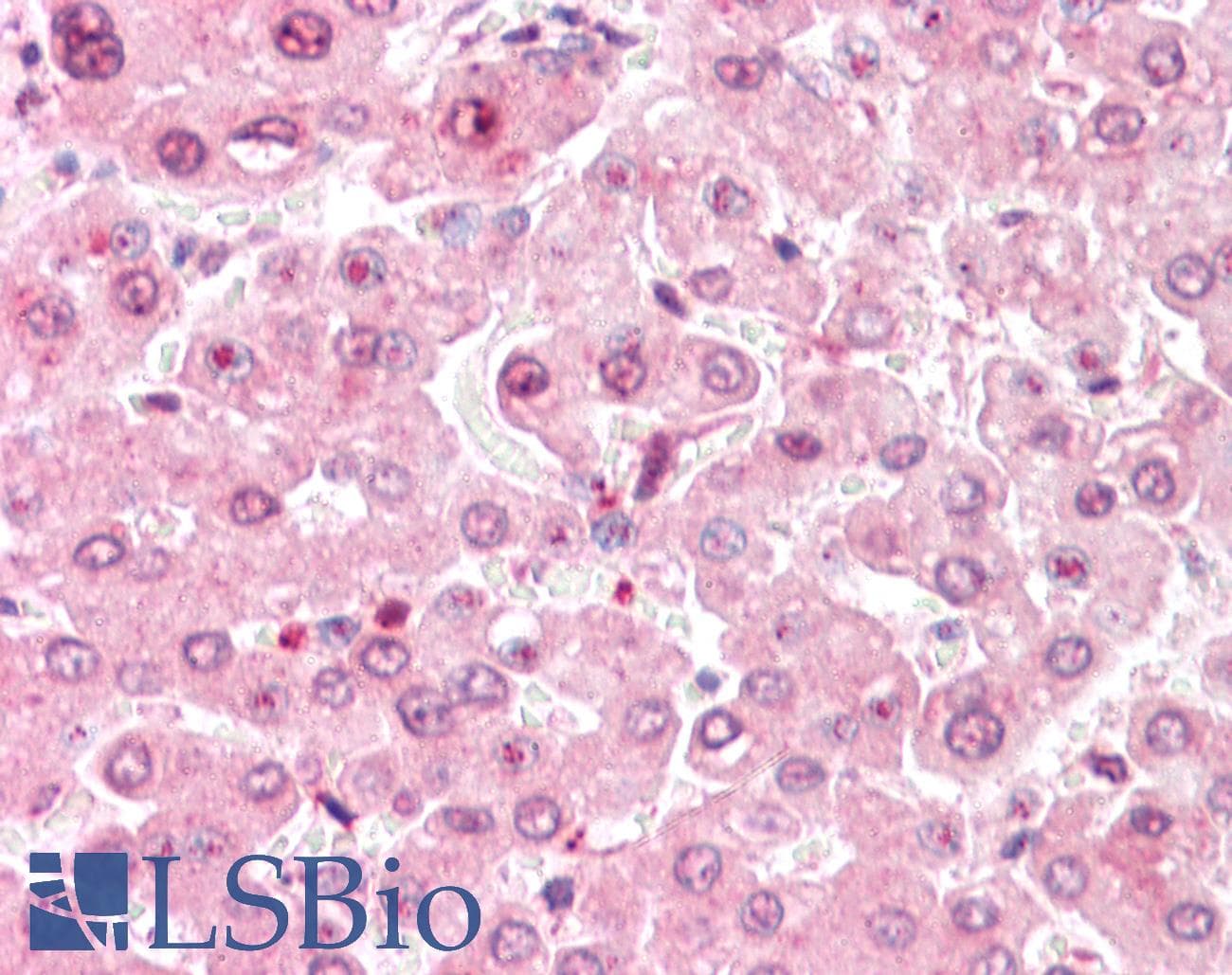 IHC-plus™ COMT Antibody (C-Terminus)