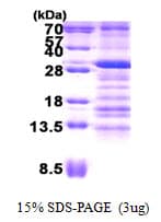 Human USE1 / p31 Protein (Recombinant His)