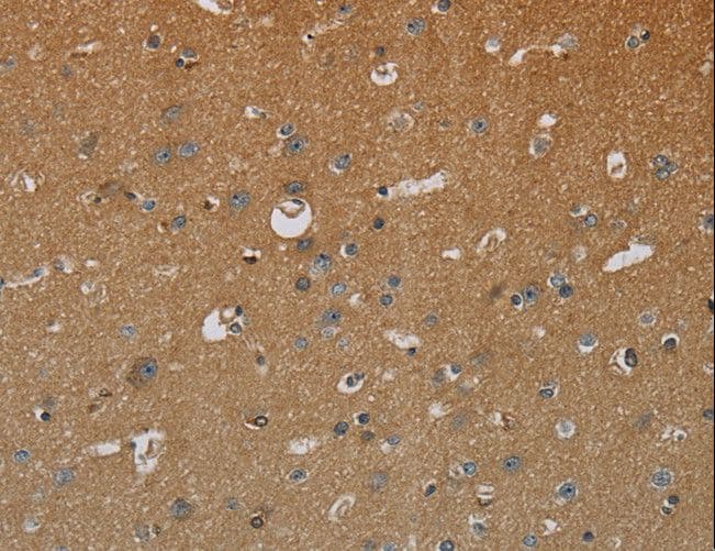 Polyclonal Rabbit anti-Human HSD17B2 Antibody (IHC)