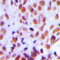 Polyclonal Rabbit anti-Human RAD21 Antibody (C-Terminus, IHC, IF, WB)