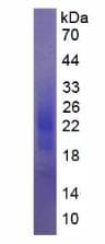 Human CSF2 / GM-CSF Protein (Recombinant)