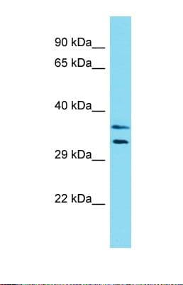 Polyclonal Rabbit anti-Human LMOD3 Antibody (aa95-144, WB)