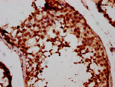 FSD1 Antibody