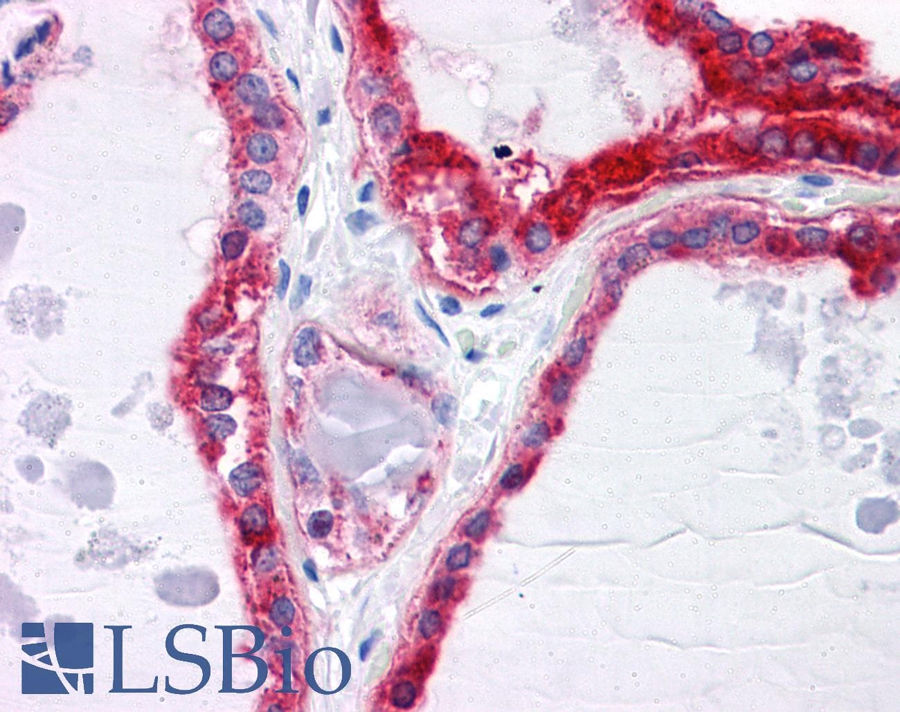 IHC-plus™ Monoclonal Mouse anti-Human CPVL Antibody (clone 2G5-1C1, IHC, IF, WB)