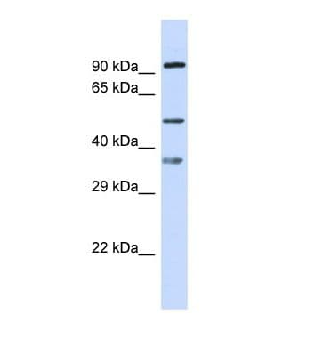 SGSH Antibody (aa23-72, Biotin)