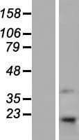 TMEM69 Protein (Over-Expression Lysate Myc-DDK (Flag))