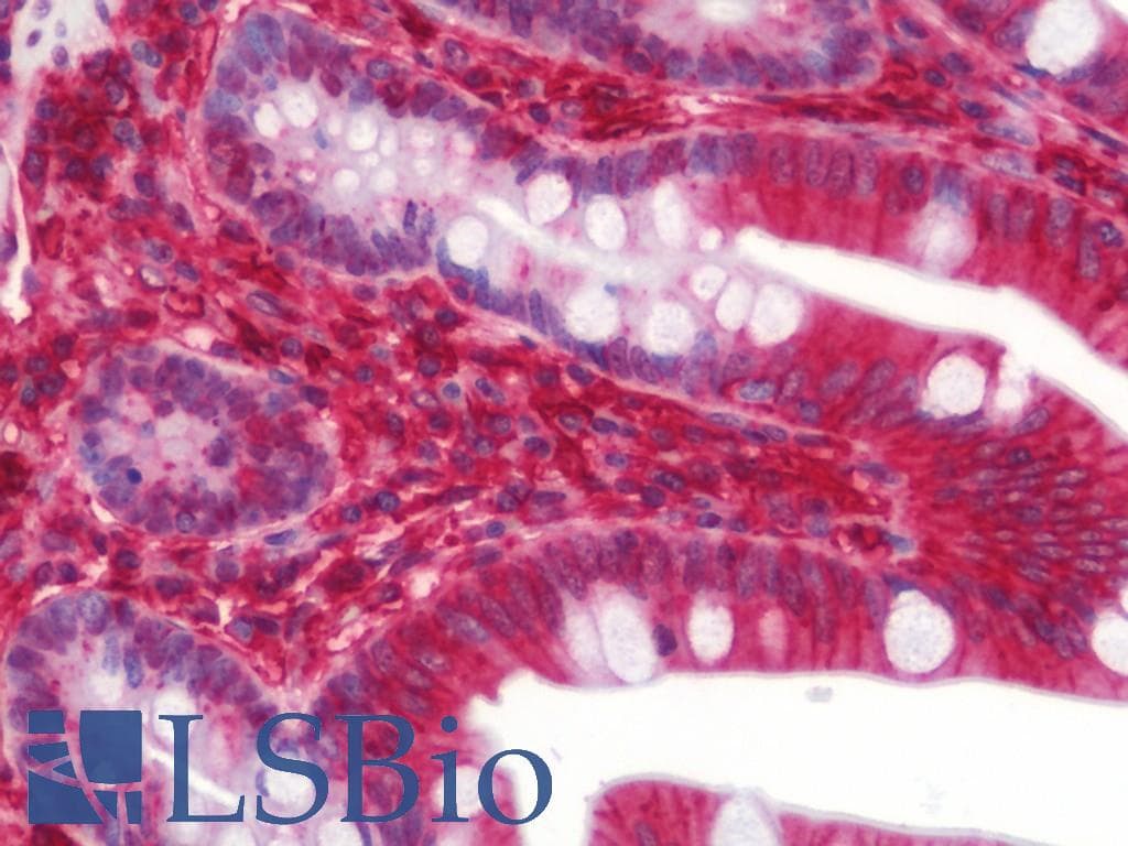 IHC-plus™ Polyclonal Rabbit anti-Human HLA-A Antibody (IHC, WB)