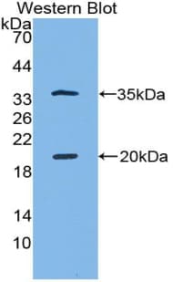 SPINK5 / LEKTI Antibody (aa699-976)