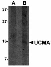 IHC-plus™ Polyclonal Rabbit anti-Human UCMA / GRP Antibody (IHC, WB)