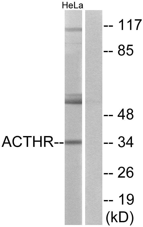 Polyclonal Rabbit anti-Human MC2R / ACTHR / ACTH Receptor Antibody (IF, WB)