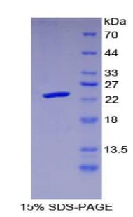 Human PRSS1 / Trypsin Protein (Recombinant His, N-Terminal)