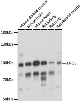 ANO5 / Anoctamin 5 Antibody