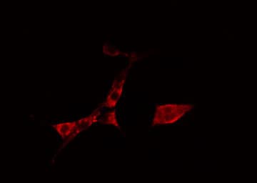 TROVE2 Antibody