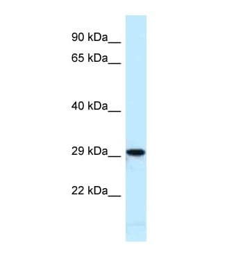 Polyclonal Rabbit anti-Mouse NFI / NFIC Antibody (aa32-81, WB)