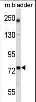 IHC-plus™ GCLC Antibody (aa286-315)