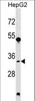 SRM / Spermidine Synthase Antibody (aa158-187)