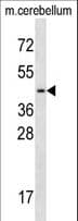 TCF7L2 / TCG4 Antibody (aa61-90)