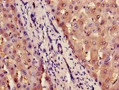 Polyclonal Rabbit anti-Human NF45 / ILF2 Antibody (IHC, WB)