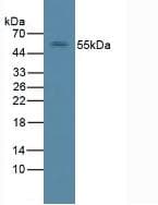ERBB2 / HER2 Antibody (aa377-579)
