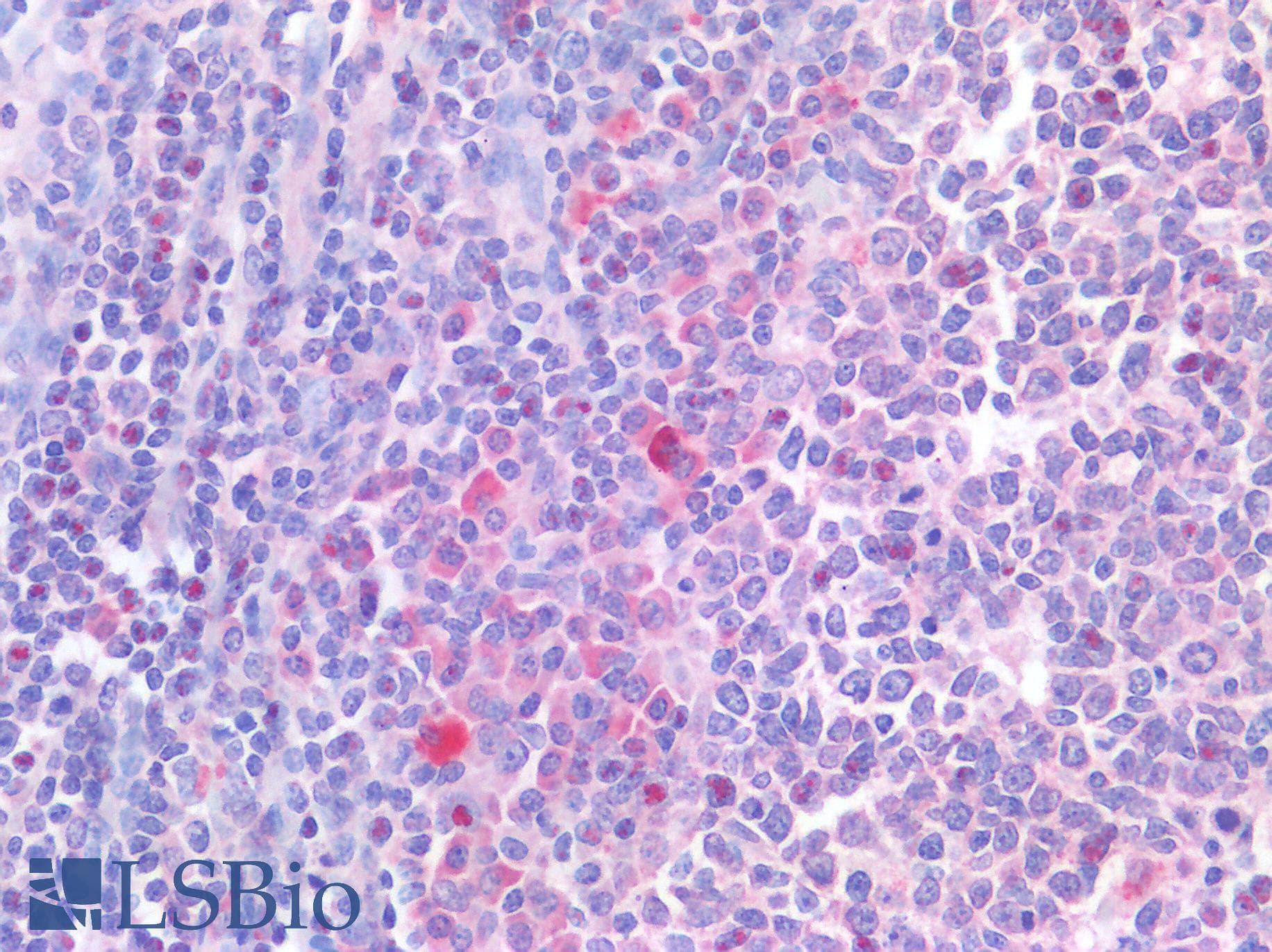 IHC-plus™ IL4 Antibody
