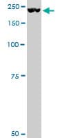 PLXNA2 / Plexin A2 Antibody (clone 2G5)