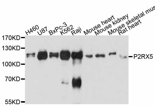 P2RX5 / P2X5 Antibody