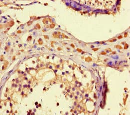ZNF408 / PRDM17 Antibody